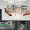 Implant Planning - Surgical Guide 